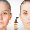 Anti-Aging Couple – Skin Care Set - Dermatologist-Tested Products for Best & Trusted Results